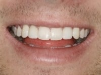 Konig Center for Cosmetic & Comprehensive Dentistry smile photos